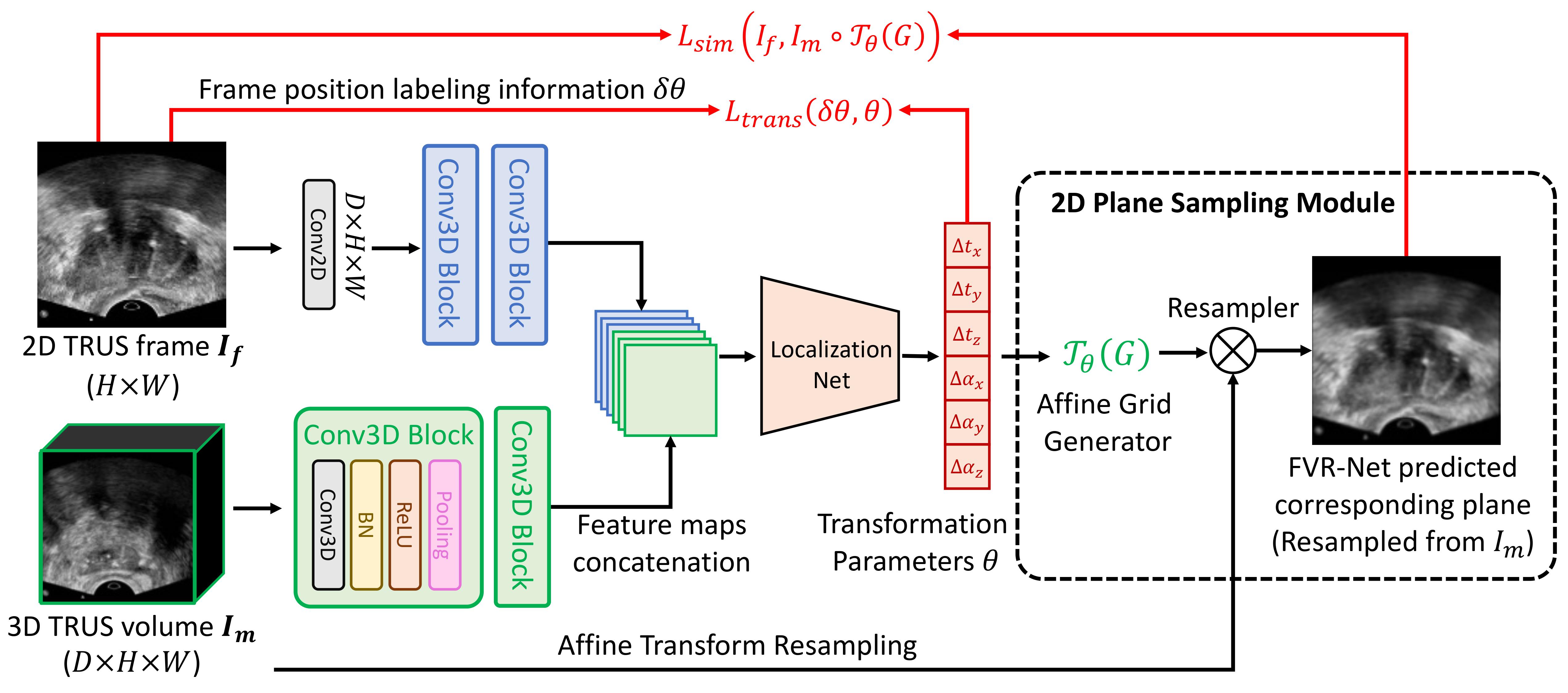 FVR-Net Architecture