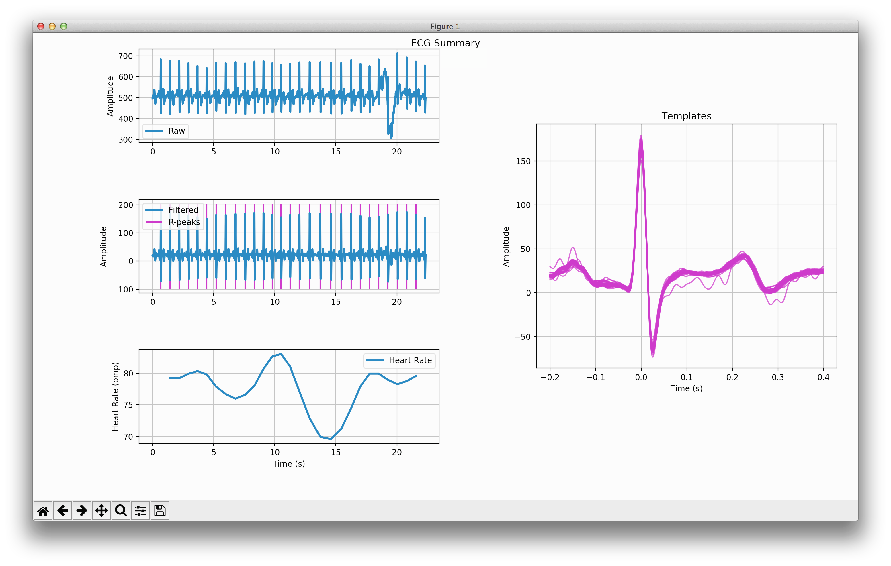 ECG Summary Plot Image