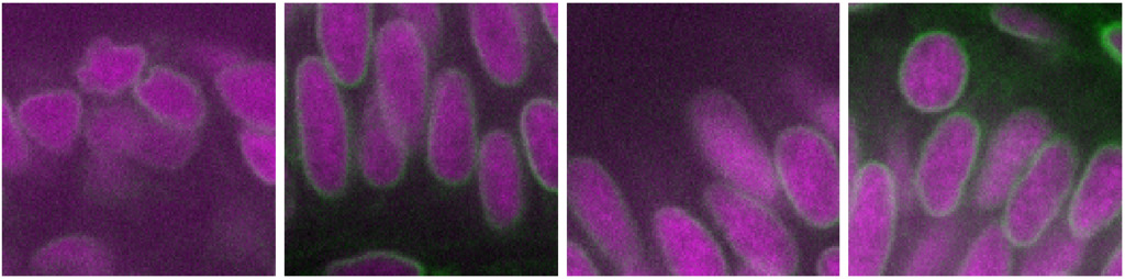 Dual color zebrafish retina